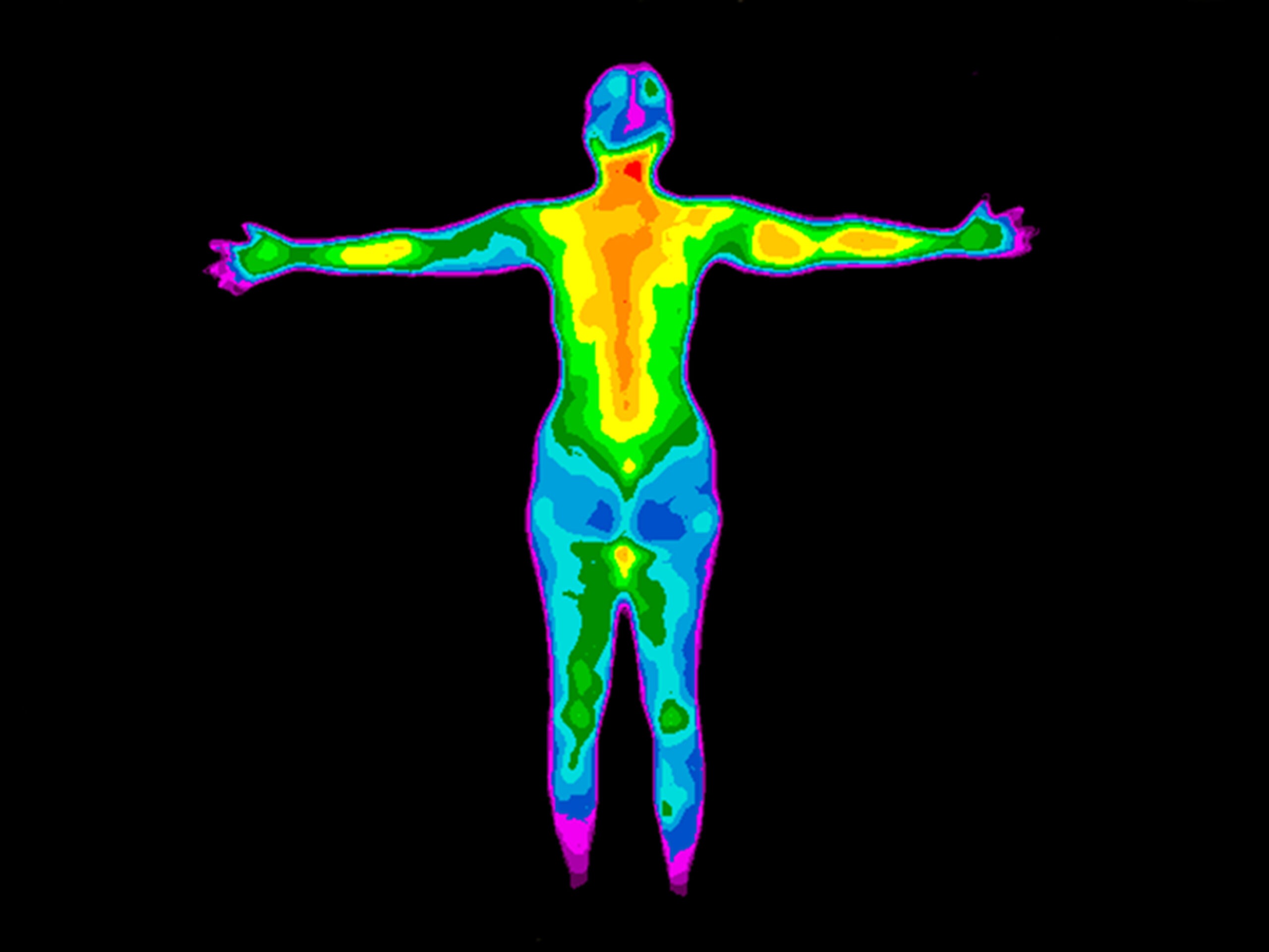 Thermographic image of the back of the whole body of a woman with the photo showing different temperatures in a range of colors from blue showing cold to red showing hot which can indicate joint inflammation.